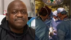 Morre primeiro paciente a receber rim de porco em transplante