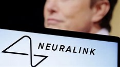 Humano recebe primeiro implante de chip cerebral de empresa de Elon Musk