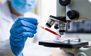 Alzheimer: Novo exame de sangue tem 97% de precisão no diagnóstico