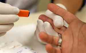 Ministério da Saúde orienta farmácias a realizar testes rápidos de HIV