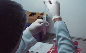 Tecnologia para tratar câncer de pele é aprovado para uso no SUS