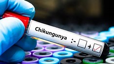 Estudo revela que chikungunya causa danos cerebrais