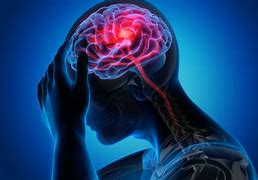 Bahia teve mais de cinco mil óbitos por AVC em 2023