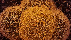 Nova subvariante da Covid-19 é identificada em Mato Grosso