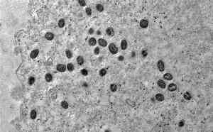 OMS alerta para variante mais perigosa de mpox