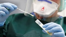 Número de pessoas internadas com covid-19 aumenta 28% em SP