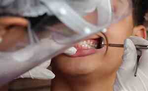 Brasil tem 45% de cobertura em saúde bucal; meta é chegar a 70%