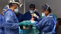 Primeiro transplante de fígado de porco em humano é realizado na China